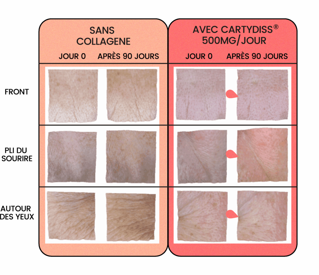 1_rides_collagene_cartydiss_gummies