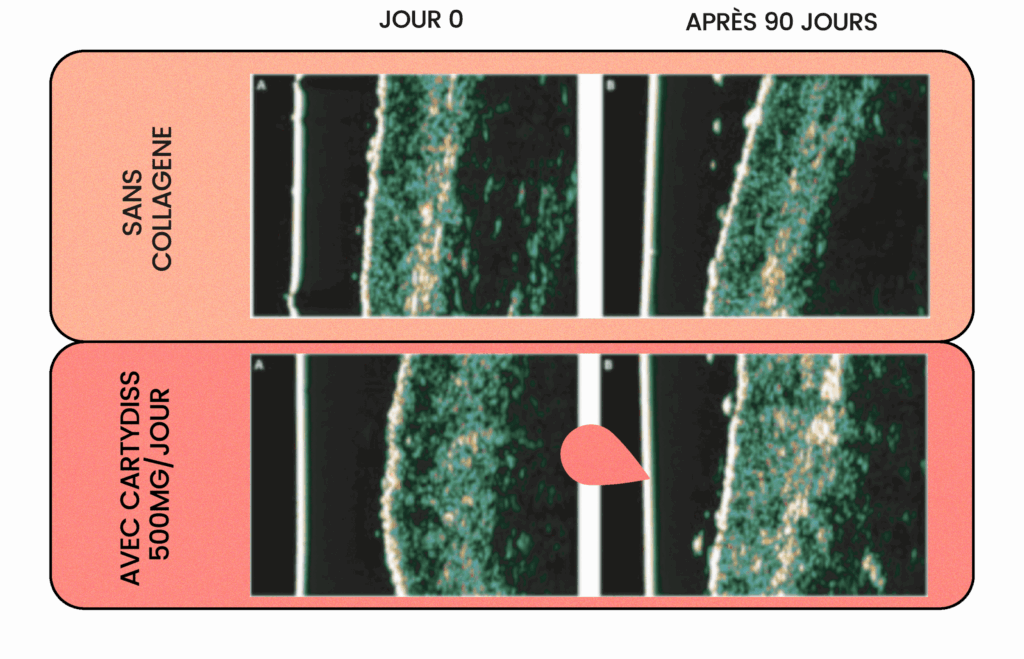 4_densite_peau_collagene_cartydiss_gummies