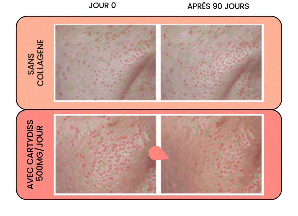 5_pores_peau_collagene_cartydiss_gummies